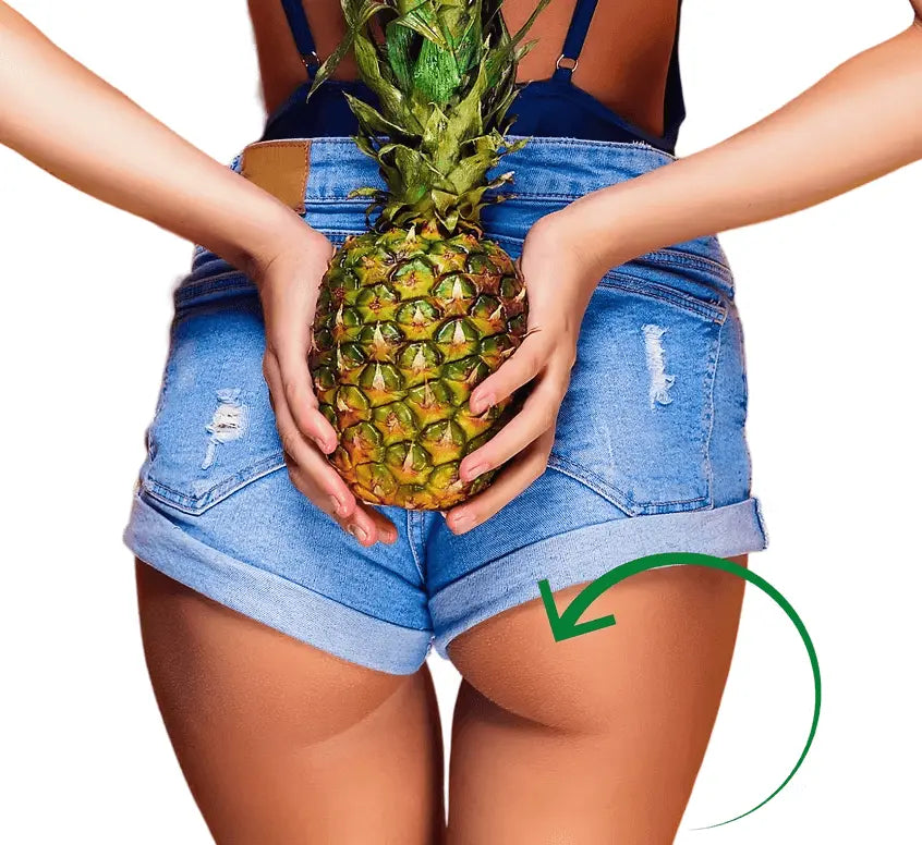 Sprezzatura Cellulite Reduction Sprezzatura